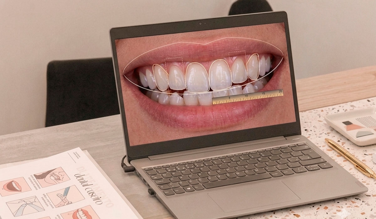 Diseño de Sonrisa · CLINO Miraflores