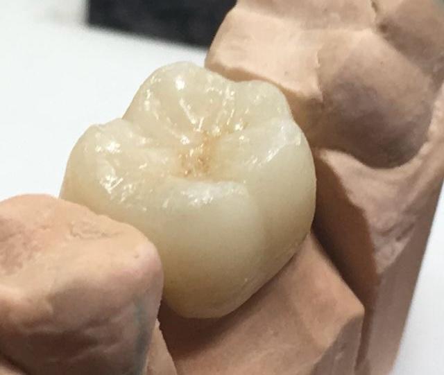Prótesis Dental · CLINO Miraflores