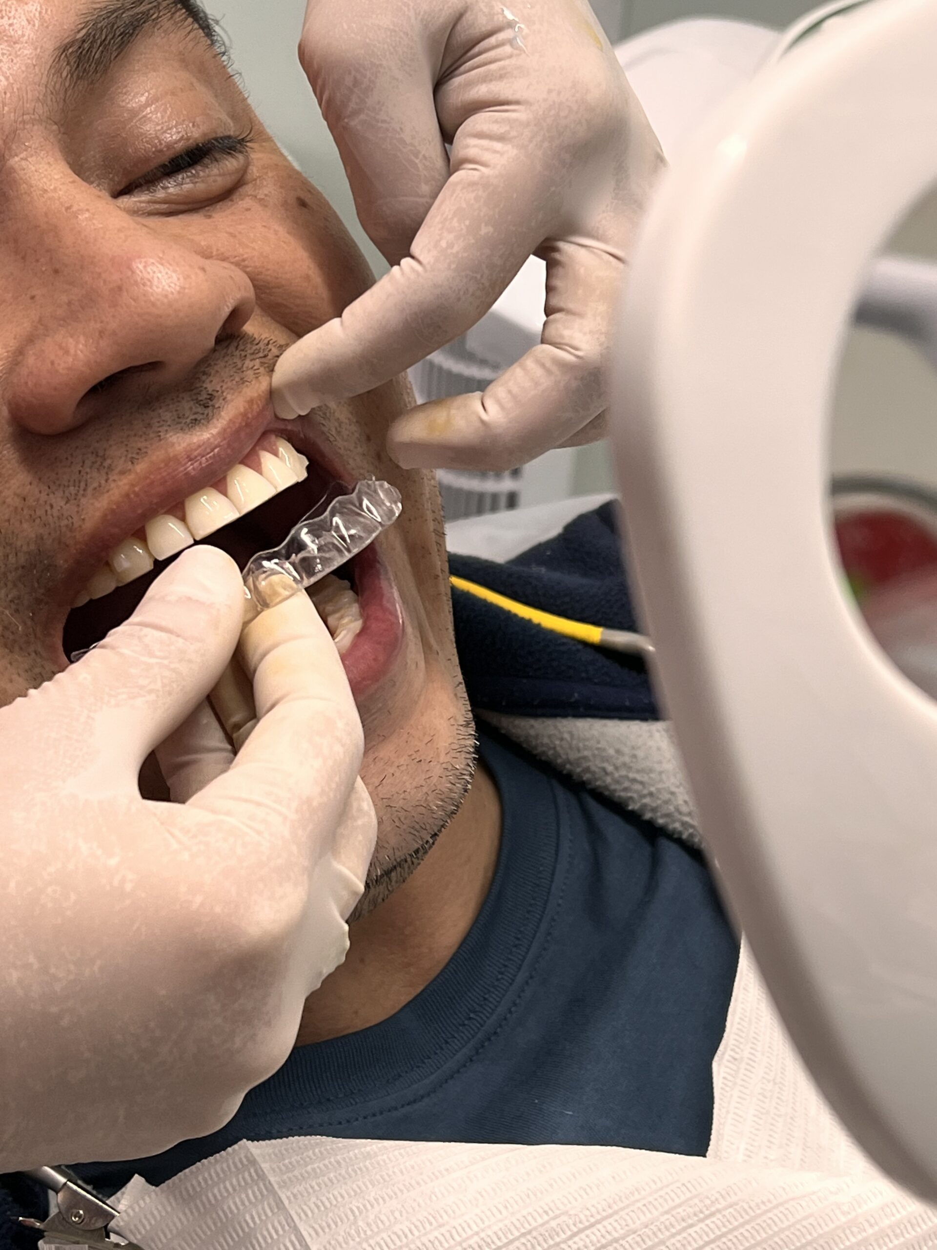 Ortodoncia con brackets y alineadores en Miraflores, CLINO
